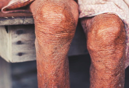 withered leg of old woman, withered tan skin, healthy and long live conceptの写真素材