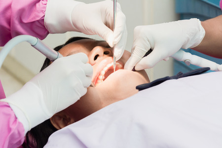 Nakhonsawan, Thailand : 2 March 2018, Dentist and Dentist assistant Checking teeth for children at sanitation.のeditorial素材