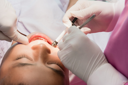 Nakhonsawan, Thailand : 2 March 2018, Dentist and Dentist assistant Checking teeth for children at sanitation.のeditorial素材