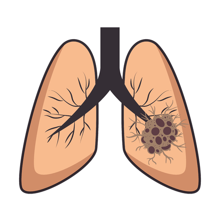 lung cancer isolated icon vector illustration designのイラスト素材