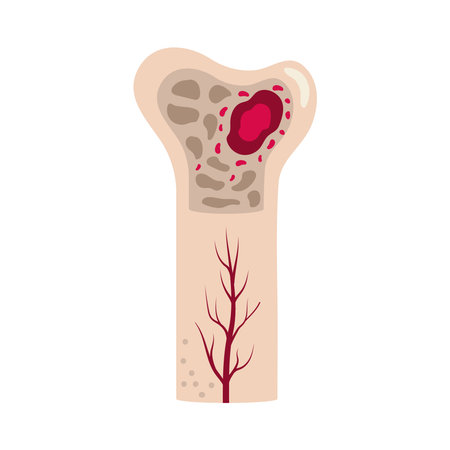 multiple myeloma disease awarenessのイラスト素材