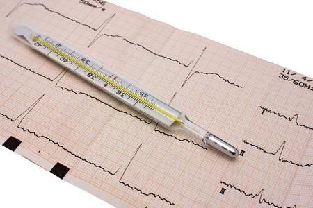 Thermometer on graph paper with the cardiogrammeの写真素材