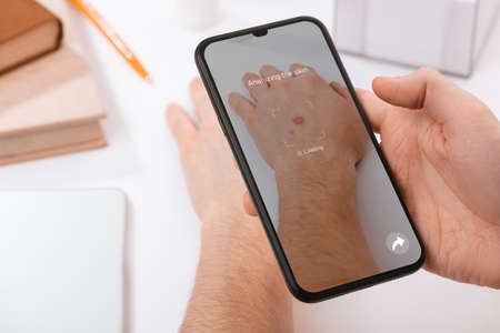 Man using a phone app to identify skin disease on his handの写真素材
