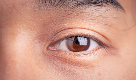 Close Up of Asian woman blinking Eyes and little freckles on her beautiful face.