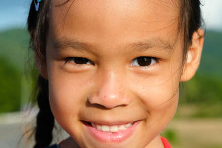 Healthy smiling face of a cute little girl with a sunburn on her face. Happy little Asian girl child showing front teeth with big smile and laughing. Beauty and health of the skin.の写真素材