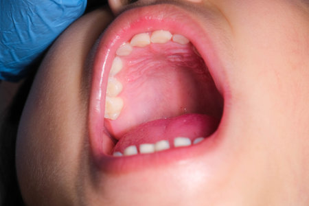 Close-up of the hard palate in the mouth of a healthy child with beautiful rows of baby teeth.の写真素材