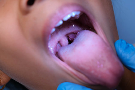 Close-up inside the oral cavity of a healthy child with beautiful rows of baby teeth. Young girl opens mouth revealing upper and lower teeth, hard palate, soft palate, dental and oral health checkup.の写真素材