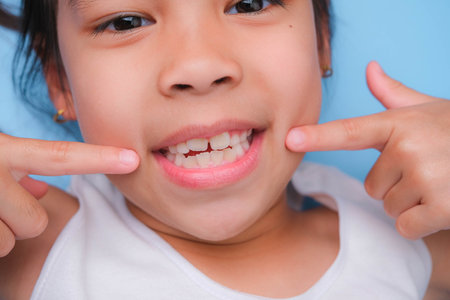 Close-up of young girl touching the corners of her mouth with index finger while smiling broadly revealing her beautiful white teeth on blue background. Concept of good health in childhood.の写真素材