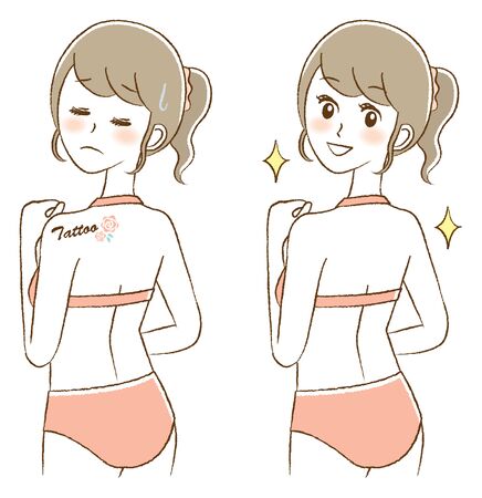 Illustration of woman who wants to erase tattoo on backのイラスト素材