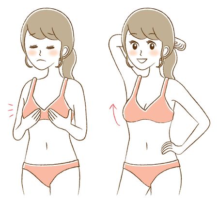 Illustration of breast augmentation surgeryのイラスト素材