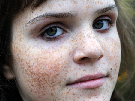 close-up portrait of freckled teenage girlの写真素材