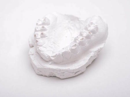 dentist gypsum impression of human jaw isolated on white backgroundの写真素材