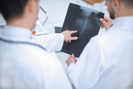 close up. diagnoses discussing the x-ray of the patient.rear viewの写真素材