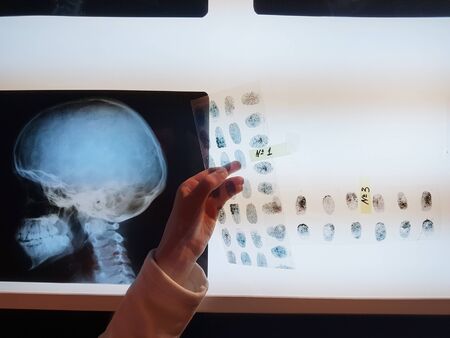 A picture with fingerprints in the hands of the girl detective.