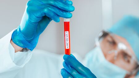 Tube with the tested test in the hands of a laboratory assistantの写真素材