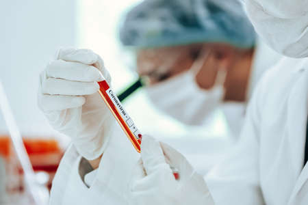 background image of a labelled tube with a coronavirus test in the hands of a laboratory assistant.
