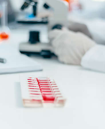 blurry image of a desktop in a medical laboratory.の写真素材
