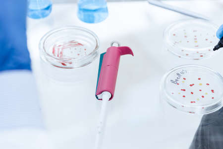 close up. scientist marking a Petri dish with viral bacteria.