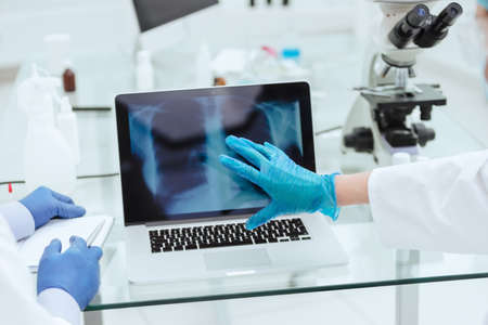 close up. doctors discussing an x-ray of the lungs.