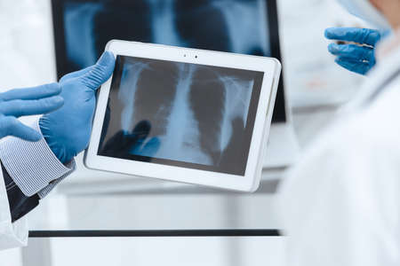 x-ray of the lungs on the screen of a digital tablet.