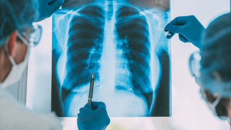 close up. doctors in protective clothing discussing an x-ray of the lungs .