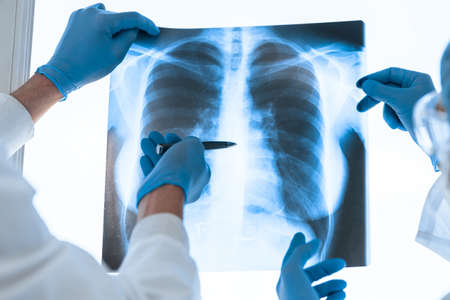 close up. medical colleagues discussing an x-ray of the lungs .の写真素材
