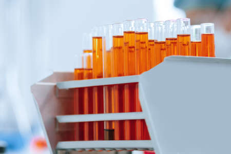 close up. tubes with test results on the lab table.
