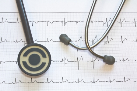 stethoscope and electrocardiogram  の写真素材