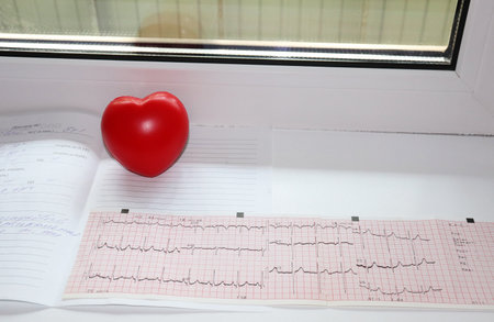 medical examination results cardiogram and rubber hand trainer in the shape of a heart