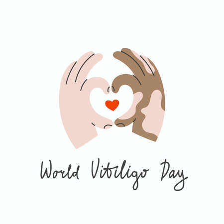 Swarthy hands with vitiligo make a heart shape gestureのイラスト素材