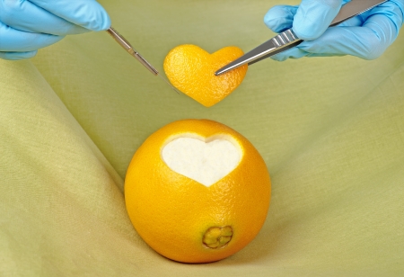 A surgeon excises  a piece in the shape of a heart from an orange の写真素材