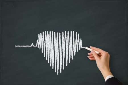 Heart beat chart sketched on a white boardの写真素材