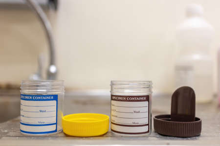 closeup shot of a specimen container for lab testの写真素材