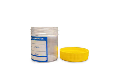 closeup shot of a specimen container for lab testの写真素材