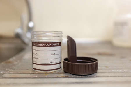 closeup shot of a specimen container for lab testの写真素材