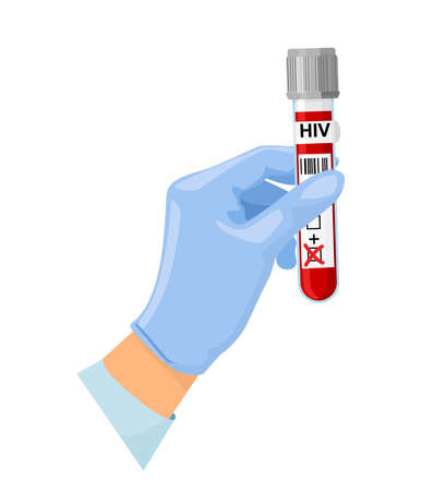 Hand with a test tube of blood test for AIDS, HIV. World AIDS Day 1 December, blood test. Vectorのイラスト素材