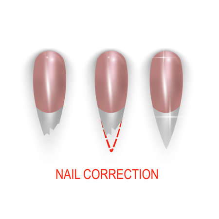 Broken or bitting nail correction. vector illustration set on white background.のイラスト素材