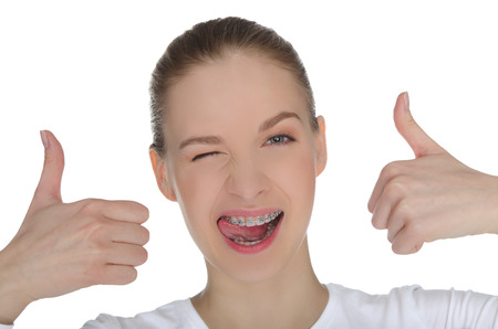Smiling happy girl with braces on teeth  isolated on whiteの写真素材