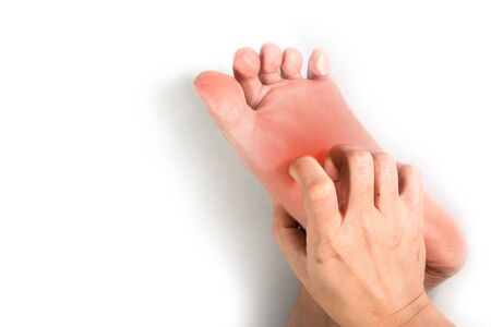 Woman hand scratching on feet with redness rash isolated on white background for healthy concept.の写真素材