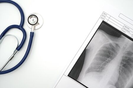 Lung x-ray To check for Covid 19 viruses or coronavirus .using as background Healthcare concept and...