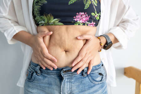 Women body fat belly. Obese woman hand holding excessive belly fat. diet lifestyle concept to reduce belly and shape up healthy stomach muscle.の写真素材