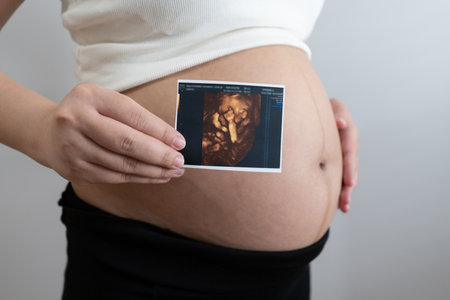 pregnant woman holds an ultrasound photo of her baby, smiling as she gazes at the image. The ultrasound shows a clear picture of the developing baby, capturing a precious moment of motherhood and anticipation.の写真素材