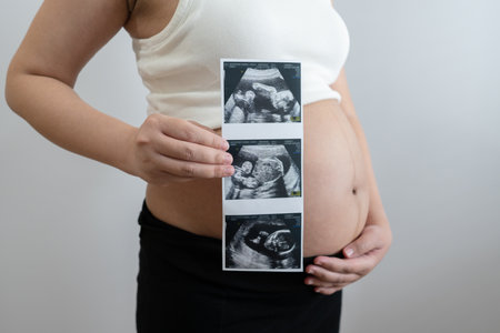 pregnant woman holds an ultrasound photo of her baby, smiling as she gazes at the image. The ultrasound shows a clear picture of the developing baby, capturing a precious moment of motherhood and anticipation.の写真素材