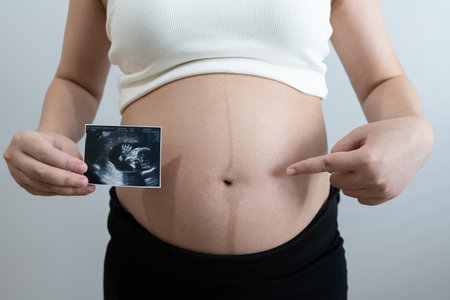 pregnant woman holds an ultrasound photo of her baby, smiling as she gazes at the image. The ultrasound shows a clear picture of the developing baby, capturing a precious moment of motherhood and anticipation.の写真素材