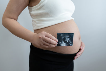 pregnant woman holds an ultrasound photo of her baby, smiling as she gazes at the image. The...