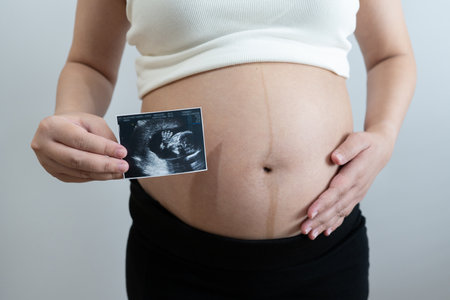 pregnant woman holds an ultrasound photo of her baby, smiling as she gazes at the image. The ultrasound shows a clear picture of the developing baby, capturing a precious moment of motherhood and anticipation.の写真素材