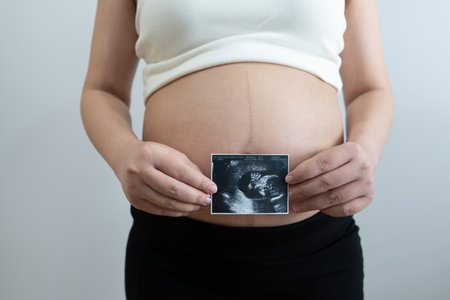 pregnant woman holds an ultrasound photo of her baby, smiling as she gazes at the image. The ultrasound shows a clear picture of the developing baby, capturing a precious moment of motherhood and anticipation.の写真素材