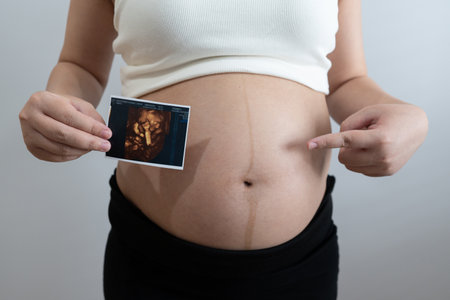 pregnant woman holds an ultrasound photo of her baby, smiling as she gazes at the image. The ultrasound shows a clear picture of the developing baby, capturing a precious moment of motherhood and anticipation.の写真素材