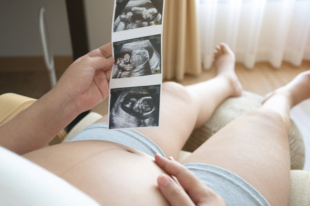 Pregnant woman holding ultrasound scan of her baby at home.の写真素材