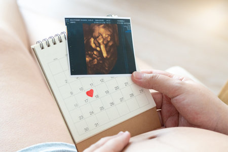 Pregnant women should prepare for childbirth by attending prenatal classes, packing a hospital bag, and arranging transportation. Itâs essential to have a birth plan, ensure all necessary documentsの写真素材